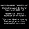 Video of hairline lowering