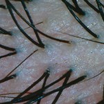 human scalp hair